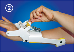 Dynamic Radial Nerve Palsy Splint