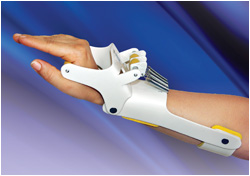 Dynamic Radial Nerve Palsy Splint